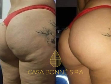 Casa Bonné Spa - Masaje Relajante